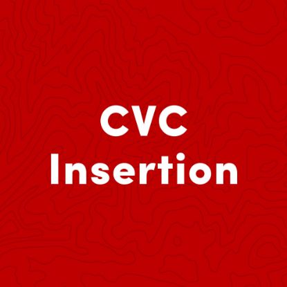 CVC Insertion